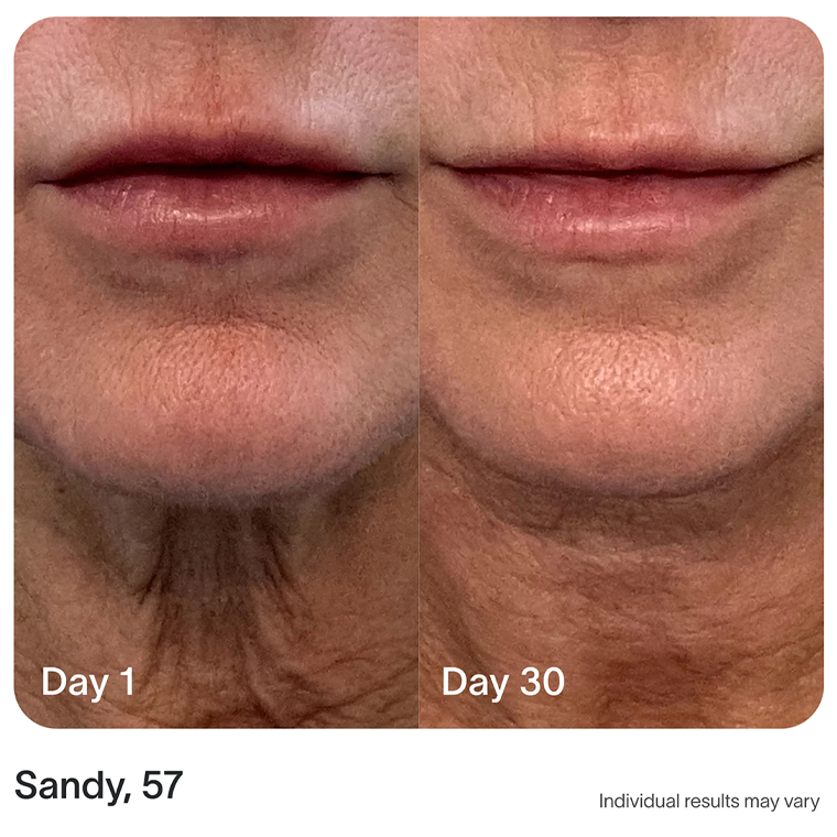 4-in-1 Radiant Renewal Skincare Wand
