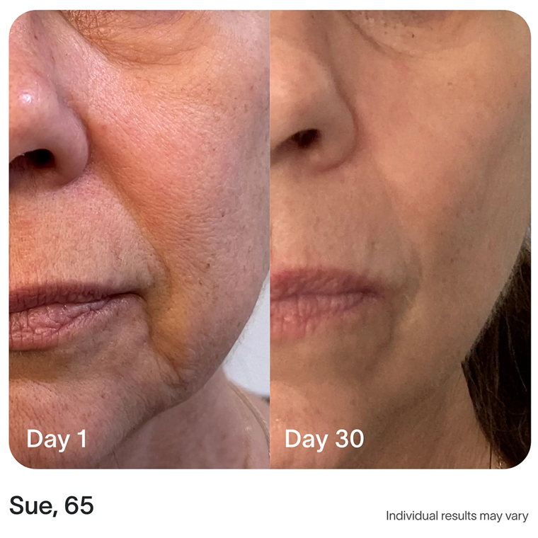 4-in-1 Radiant Renewal Skincare Wand