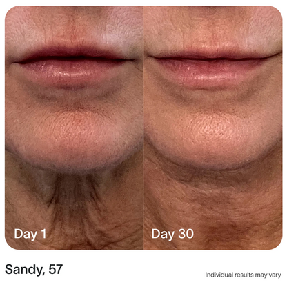 4-in-1 Radiant Renewal Skincare Wand